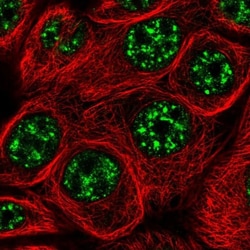 C6orf52 Antibody, Novus Biologicals 25ul | Buy Online | Novus Biologicals | Fisher Scientific